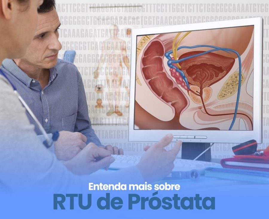 Cirurgia de Próstata ( RTU ) - Dr. Thiago Bruno | Urologista - Urologia -  Natal/RN